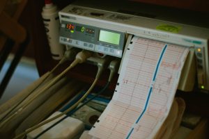 The Most Common Scams For Health Workers Ecg-Machine-Reads